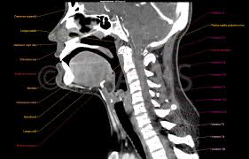 Ct Head Anatomy Anatomy Drawing Diagram