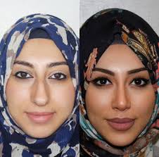 Cosmetic Surgery and Public Figures' Appearances