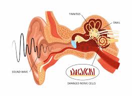Are you Hearing Ringing in your Ears? We are Tinnitus Treatment Specialist