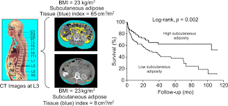 Casimir m english, french english form of the polish name kazimierz, derived from the slavic element kaziti to destroy combined with miru peace, world. Low Subcutaneous Adiposity Associates With Higher Mortality In Female Patients With Cirrhosis Journal Of Hepatology