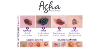 Skin cancer is one of the most common types of cancer. Skin Cancer Specialist Acworth Ga Douglasville Ga Amr Agha Md Dermatology Advanced Dermatology Pc