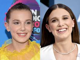 Millie Bobby Brown transformed her smile with what appears to be a  combination of clear aligners, teeth whitening, and veneers