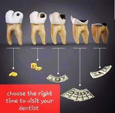 Dental bridges (per tooth) $500 (plus cost of dental crowns) $1,200 (plus. How Much Does A Dental Visit Cost Sedation And Implant Dentistry Of Tehachapi With Jose David Sanchez D D S