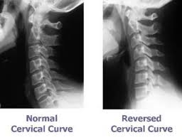 They show pictures of your internal tissues, bones, and organs. Cervical Spine Images Life Chiropractic Centre