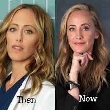 Then and Now 🌟 Kim Raver 🌟