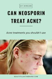 Can You Use Neosporin To Treat Acne Beautiful With Brains
