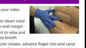 Rectal Exam - Youtube