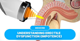 Image result for Erectile Dysfunction