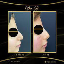 Basem Halabi's Instagram, Twitter & Facebook