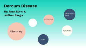 Dercum Disease By Janet Reyes