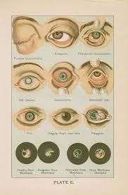 Antique Eye Diseases Health Illustration Chart 1897
