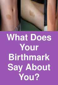 Birthmark On Leg Meaning What Does Your Birthmark Say About You What Does A Birthmark On Your Bottom Mean Birthmarks On B Birthmark Social Well Being Things To Do With Your Boyfriend