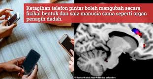 Penggunaan telefon pintar yang berlebihan antara sebab ketagihan. Ketagihan Telefon Bimbit Sebabkan Otak Seseorang Berubah Secara Fizikal