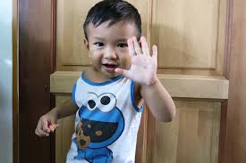 Chickenpox is an infection caused by the varicella zoster virus. Chicken Pox Kering Dalam 7 Hari Ibu Ini Kongsi Tips Cara Penjagaannya