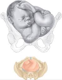 Normal Labor Williams Obstetrics 24th Edition