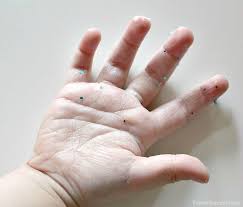 I've said my piece and settled my debts. Glitter Germs Activity For Kids The Simple Parent