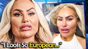 Darcey Spent $1,000,000 to look like this