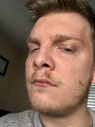 Well, sugar is a natural exfoliating agent, and warm sugar sticks to your hair, not skin. Any Tips For Blondes Facial Hair Growing In With So Many Shades Of Blonde Looks Baadddddd Beardadvice