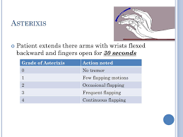 Asterixis (also called the flapping tremor, or liver flap) is a tremor of the hand when the wrist is extended, sometimes said to resemble a bird flapping its wings. Ppt Cirrhosis The Good The Bad And The Ugly Powerpoint Presentation Id 3096135