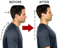 Purchasing the truefit posture corrector. The Truefit Posture Corrector
