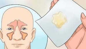 Eliminez L Infection Des Sinus En Quelques Minutes Avec Ce Que Vous Avez Dans Votre Cuisine Getting Rid Of Mucus Getting Rid Of Phlegm Sinusitis