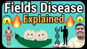 It is named after two twins, catherine and kirstie fields from wales. Fields Disease Explained How It Is Caused Youtube