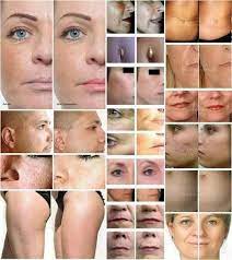 Pin On Dermapen