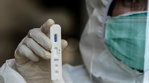 All pcr test kits and swabs. Millions Of Uk Covid 19 Testing Kits Not Good Enough