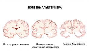 10. Снижение самообслуживания
