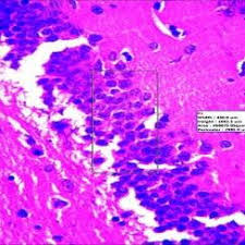 Image result for Morinda angolensis