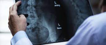 Perbedaan antara akut dan kronis ini nantinya dapat menentukan diagnosis penyakit anda dengan jelas. Penyakit Ginjal Akut Atau Kronis Kenali Penyebabnya Guesehat