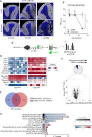 Find out if your smartphone's gpu can handle the latest games such as pubg and fortnite. Neuronal Metabolic Rewiring Promotes Resilience To Neurodegeneration Caused By Mitochondrial Dysfunction Science Advances