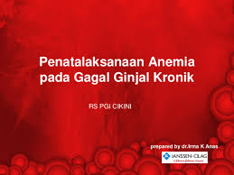 Asuhan gizi terstandar untuk pasien penyakit ginjal kronik …. Ppt Anemia Pada Gagal Ginjal Kronik Roja Fathul Academia Edu