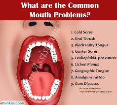 Pin On Face Mouth And Throat Pain