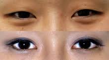 A top testing and technical consulting institute of the world serving the customers. Korean Beauty Standards Wikipedia