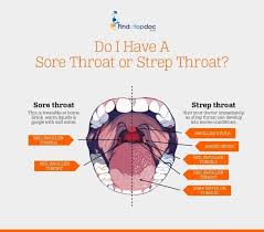Image result for Strep throat infection roof of mouth