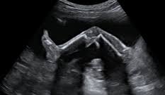 ¿viajar acompañada luego de la semana 22? Semana 22 De Embarazo Inatal El Embarazo Semana A Semana