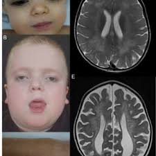 Rebecca AHRENS-NICKLAS