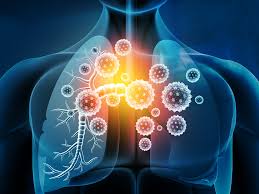 Dexamethasone Shows Benefit In Treating Covid 19 In Recovery Trial 2020 06 16 Bioworld