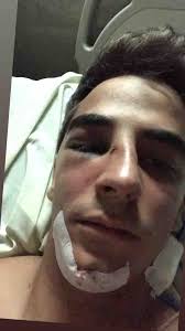 Fundraiser by Pedro Rodriguez : Help Jhonny's Surgery