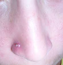 How To Get Rid Of The Bump On Your Nose Piercing Nose Piercing Body Piercings Piercing