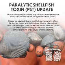 Image result for Amnesic Shellfish Poisoning