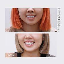 顏芳筠醫師| Dr. Lucy Yan