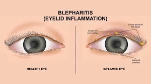 Image result for Blepharis bainesii