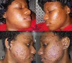 Natural facial services