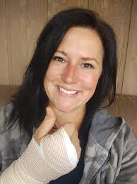 Well, carpal tunnel surgery number two