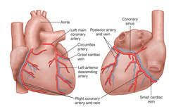 Lad Definition Of Lad By Medical Dictionary Medical Dictionary Medical Terms Arteries