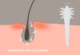 Image result for Demodex folliculorum