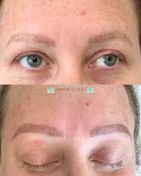 Lara Day Spa and Laser Clinic