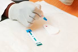 How much does a pcr test cost in france ? Hiv Tests Uses Side Effects Procedure Results